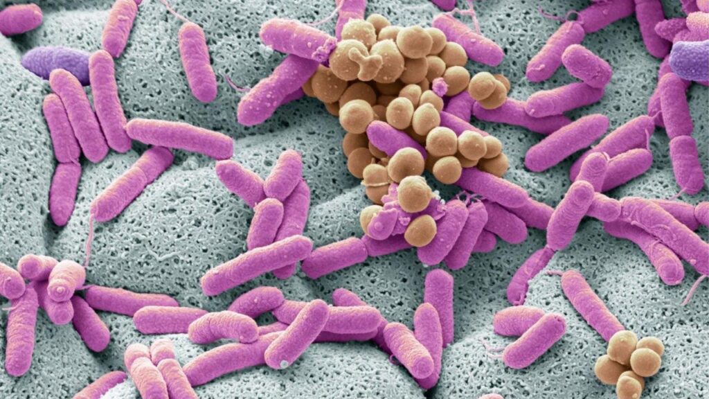 Microbiologie alimentaire : comprendre les micro-organismes et leur rôle dans les aliments